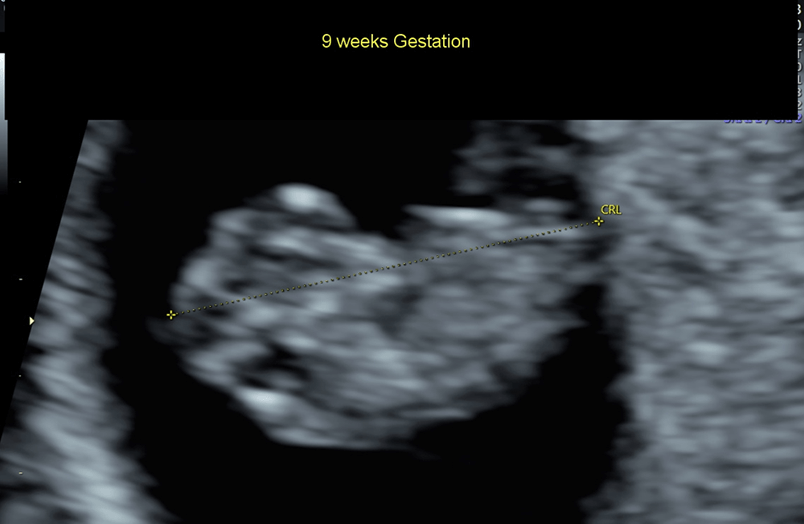 Pregnancy Calculator - Week 10