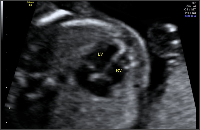 Pregnancy Calculator - Week 18