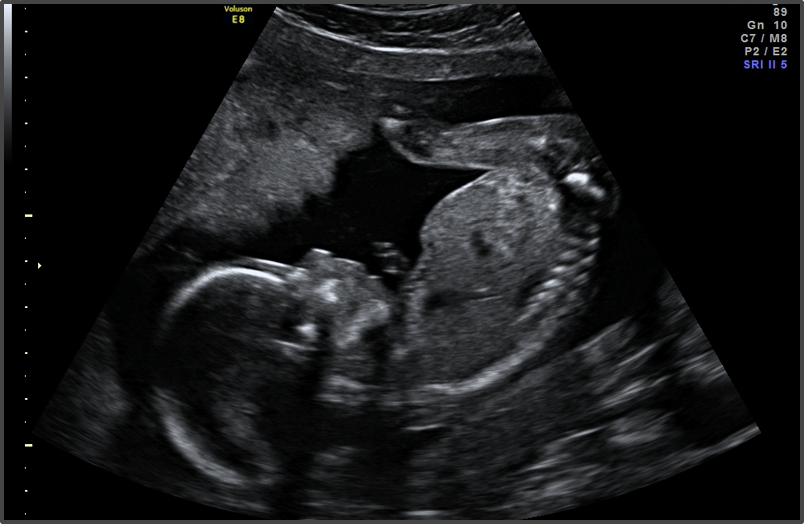 Pregnancy Calculator - Week 19