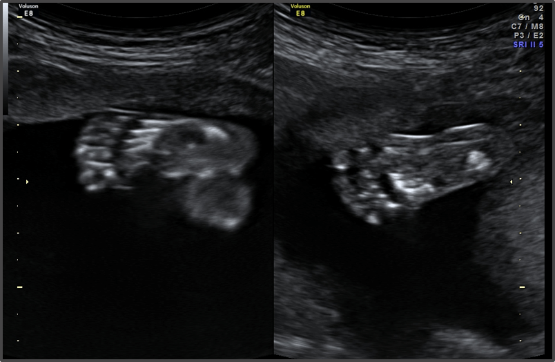 Pregnancy Calculator - Week 20