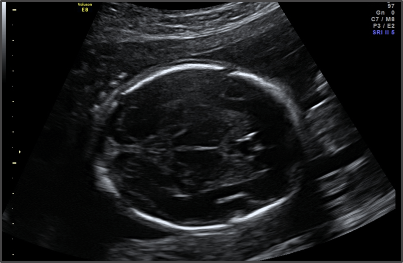 Pregnancy Calculator - Week 21