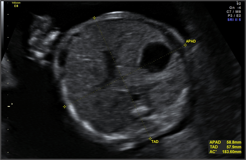 Pregnancy Calculator - Week 22