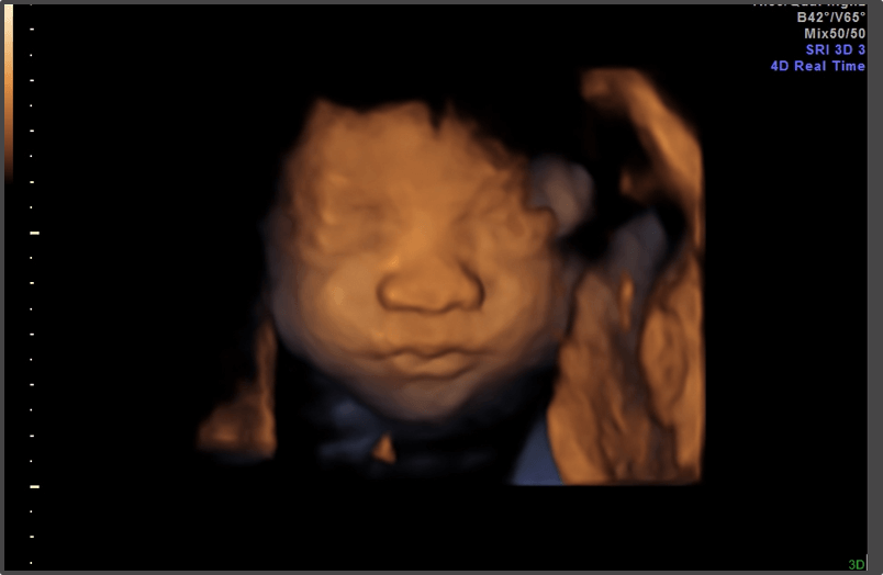 Pregnancy Calculator - Week 27