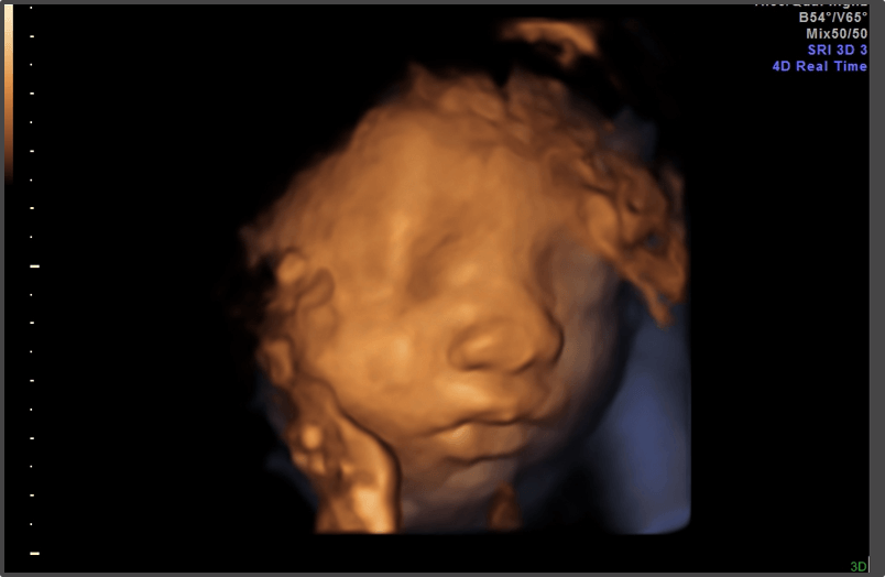 Pregnancy Calculator - Week 28