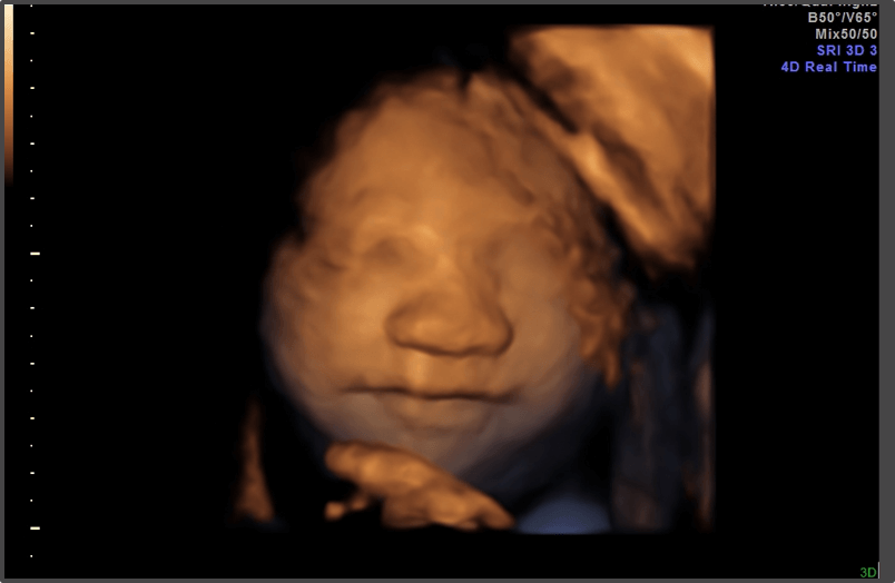 Pregnancy Calculator - Week 29