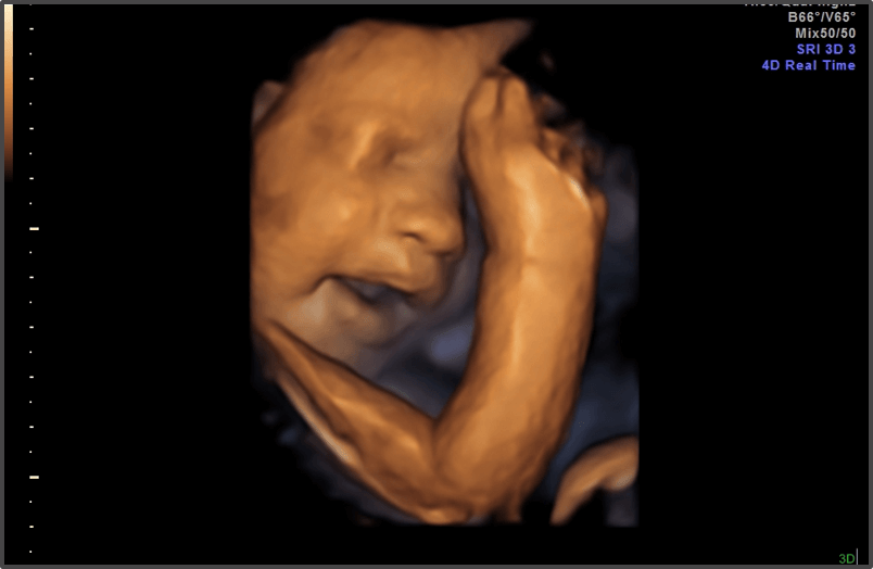 Pregnancy Calculator - Week 31
