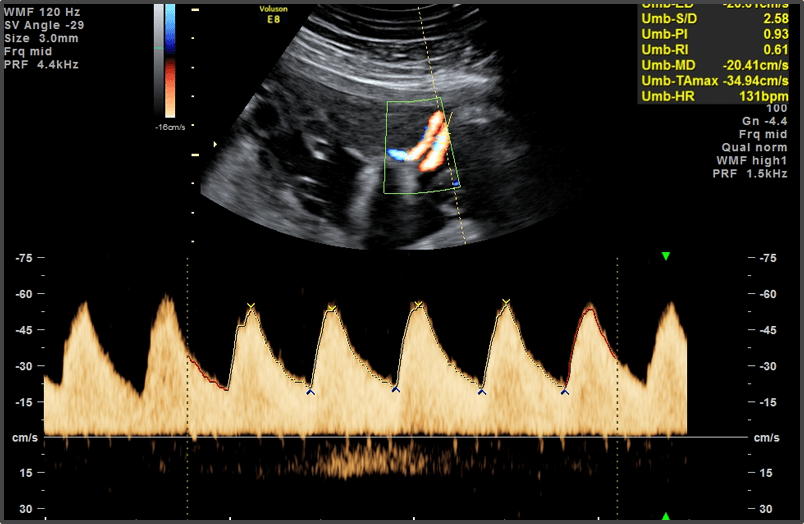Pregnancy Calculator - Week 32