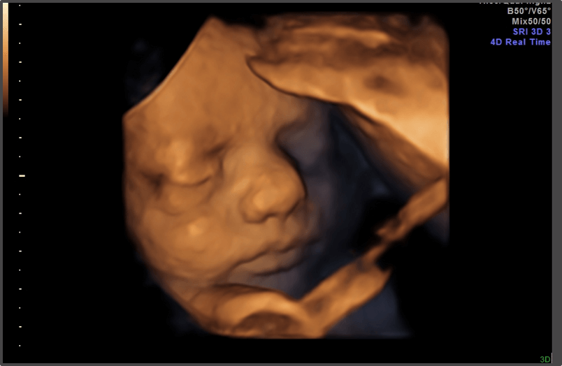 Pregnancy Calculator - Week 34