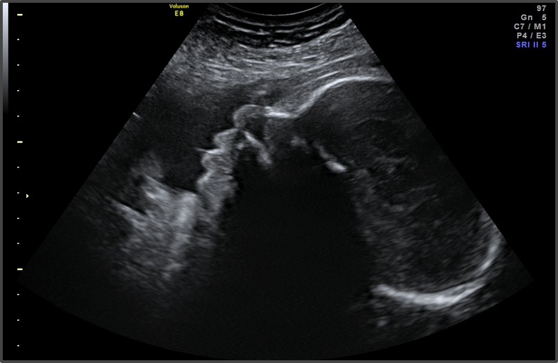 Pregnancy Calculator - Week 35