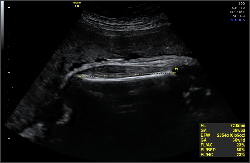 Pregnancy Calculator - Week 36