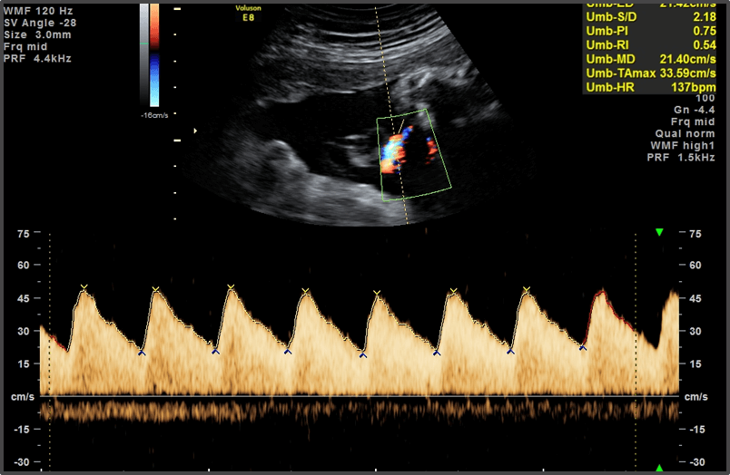 Pregnancy Calculator - Week 37