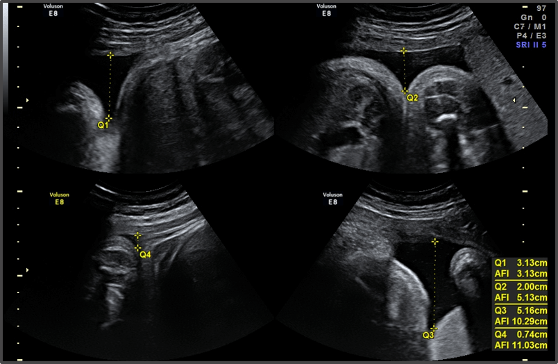 Pregnancy Calculator - Week 38