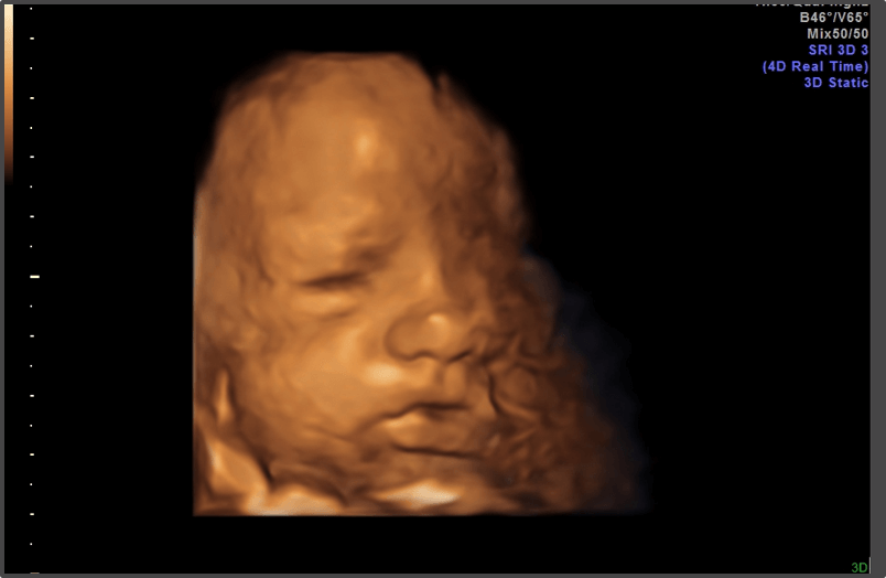 Pregnancy Calculator - Week 39
