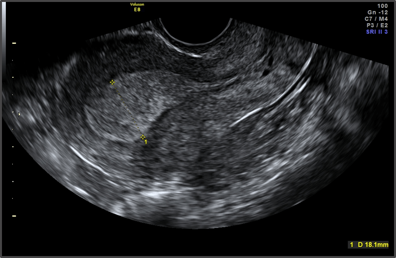 Pregnancy Calculator - Week 4