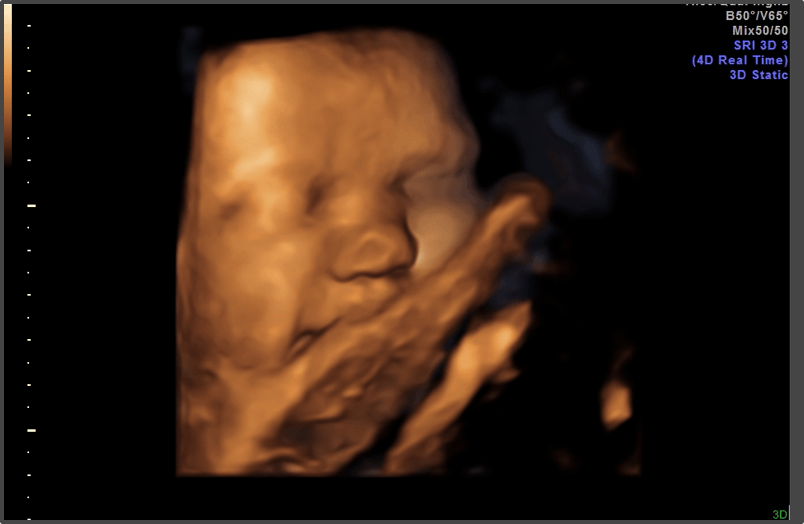 Pregnancy Calculator - Week 40