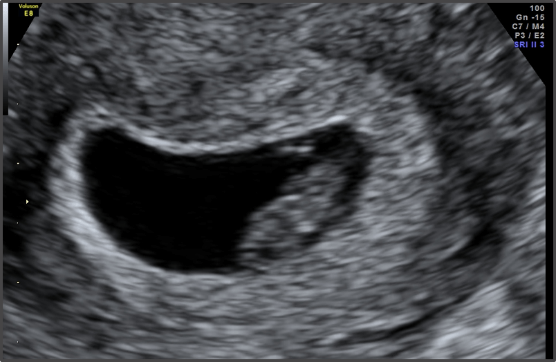 Pregnancy Calculator - Week 7